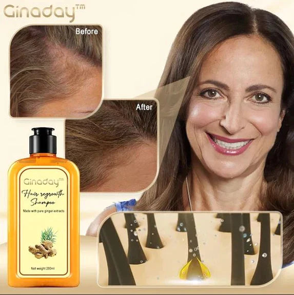 Ginaday | Stimuleer je haargroei