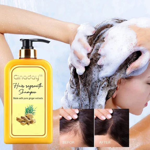 Ginaday | Stimuleer je haargroei