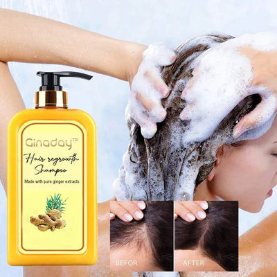 Ginaday | Stimuleer je haargroei