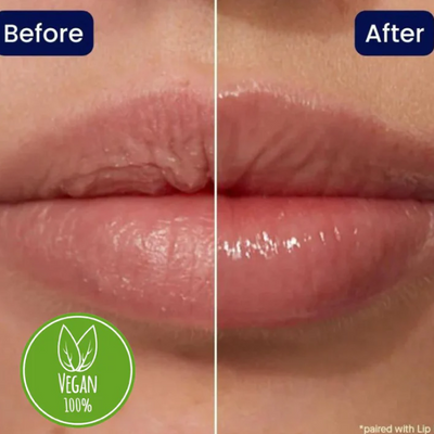 Lip Maximiser | Laat je lippen weer stralen