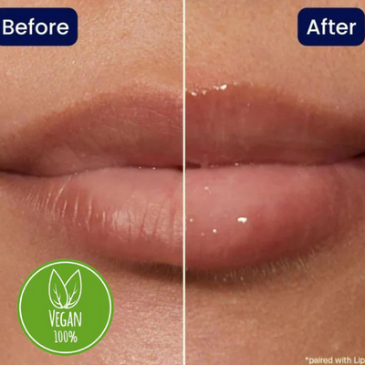 Lip Maximiser | Laat je lippen weer stralen
